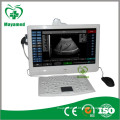 MY-A006 Touch screen handheld Ultrasound Scanner